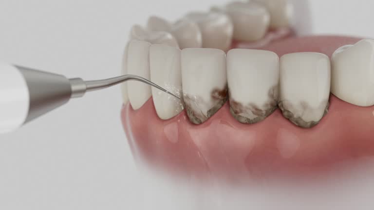 Reliable Dental Implants contractor in Hailey, ID by Smile Center Dentistry